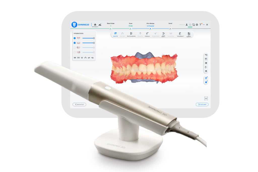 口腔内スキャナー