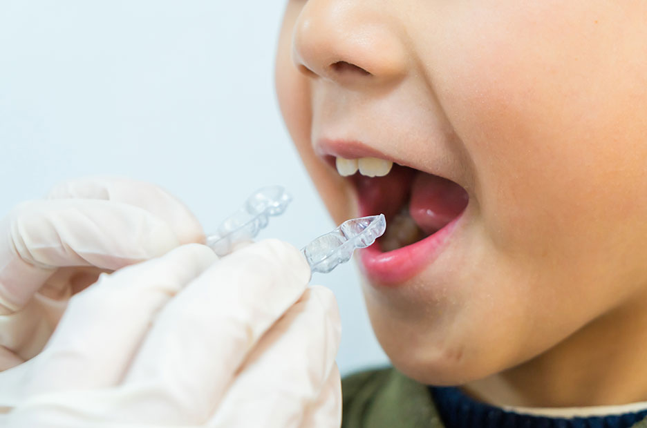 お口の健康、全身の健康をつくる 矯正治療